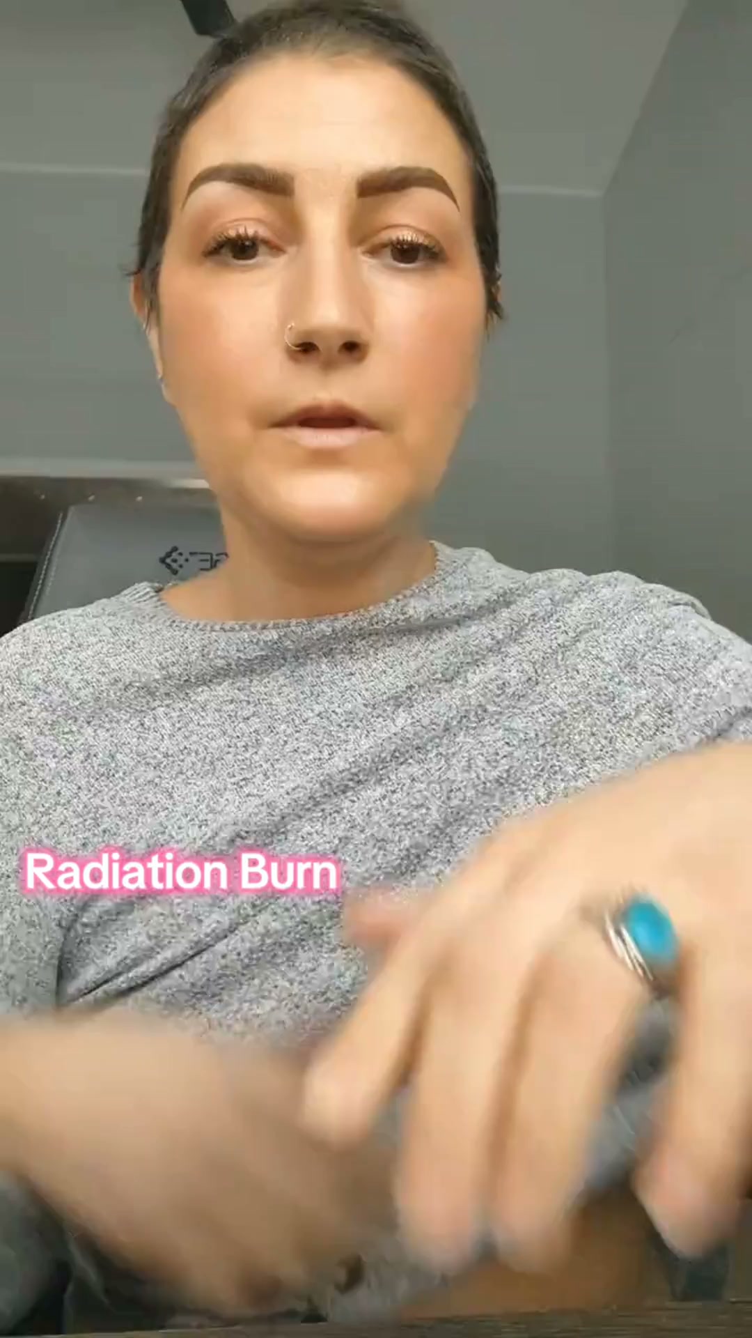 Dermavitality ad: Radiation burn, with its own page.
