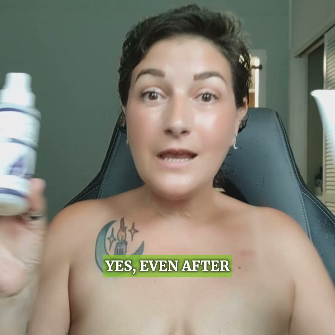 Dermavitality ad: 22 rounds of radiation, in her own words.